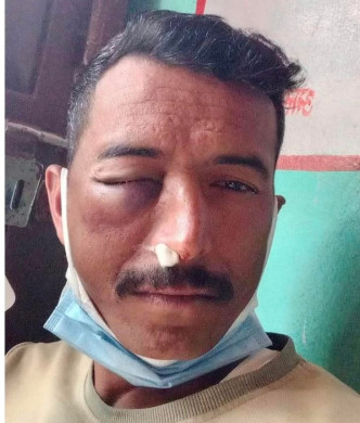 इन्स्पेक्टरले कुटे हवल्दार